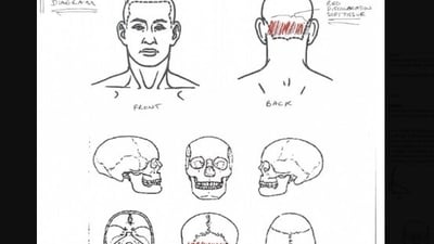 Nolan Wells autopsy: Chief Medical Examiner Dr. Roger Mitchell held a press conference at the NAACP National Convention to share preliminary findings from an independent autopsy into the death of 18-year-old Nolan Wells.
