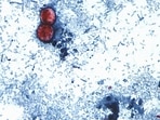 FILE - This undated photo taken through a microscope provided by the CDC shows Cyclospora cayetanensis oocysts found in a fresh stool sample.