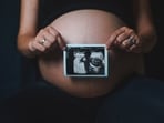 The essential IVF terms every couple should know before consulting a specialist.