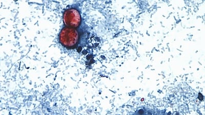 FILE - This undated photo taken through a microscope provided by the CDC shows Cyclospora cayetanensis oocysts found in a fresh stool sample. (CDC via AP)
