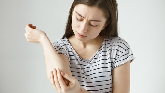 Don't ignore unexplained bruises! (Picture credit: Freepik)