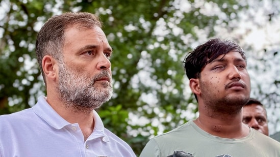 Rahul Gandhi shows student's wounds on camera, claims pellet guns used during Jantar Mantar protest