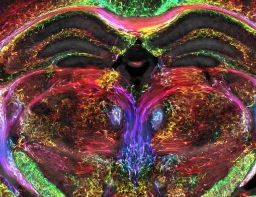 The sharpest colourful image of a brain scan; 2023. Duke University The sharpest colourful image of a brain scan; 2023. Duke University