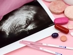 IVF 