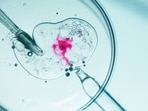 IVF