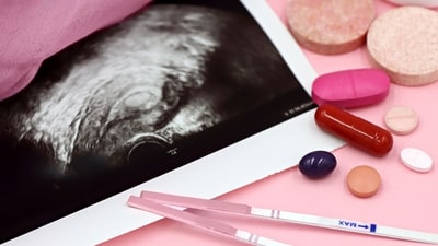 IVF (Pexel) IVF (Pexel)