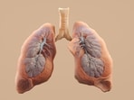 Reasons why healthy non-smokers are being diagnosed with lung cancer.