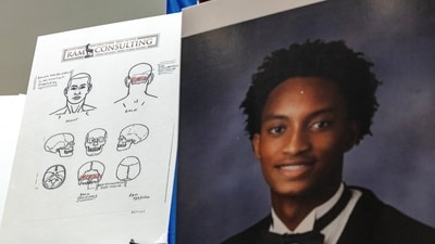 Diagrams depicting Nolan Wells' body parts are displayed during the announcement of the results of an independent autopsy at the NAACP Convention in Chicago on July 22. (REUTERS)