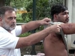 Congress leader Rahul Gandhi with a pellet injury victim. (ANI)