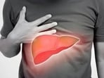 Viral hepatitis screening to take place in Liver Clinic on Friday. (HT File)