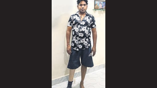 23 years on, justice for railway commuter who lost a leg