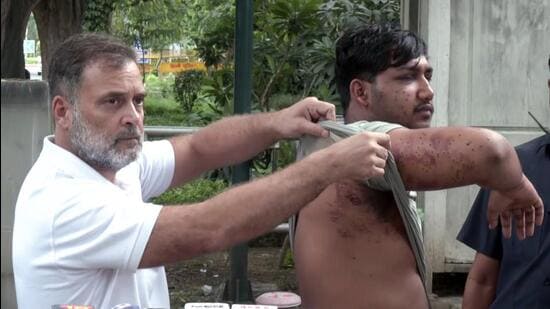 Congress leader Rahul Gandhi with a pellet injury victim. (ANI)