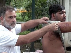 নিট (NEET) প্রশ্নফাঁসের প্রতিবাদে ২০ জুলাই অনুষ্ঠিত বিক্ষোভে পুলিশের বলপ্রয়োগ নিয়ে নতুন তথ্য সামনে এসেছে।