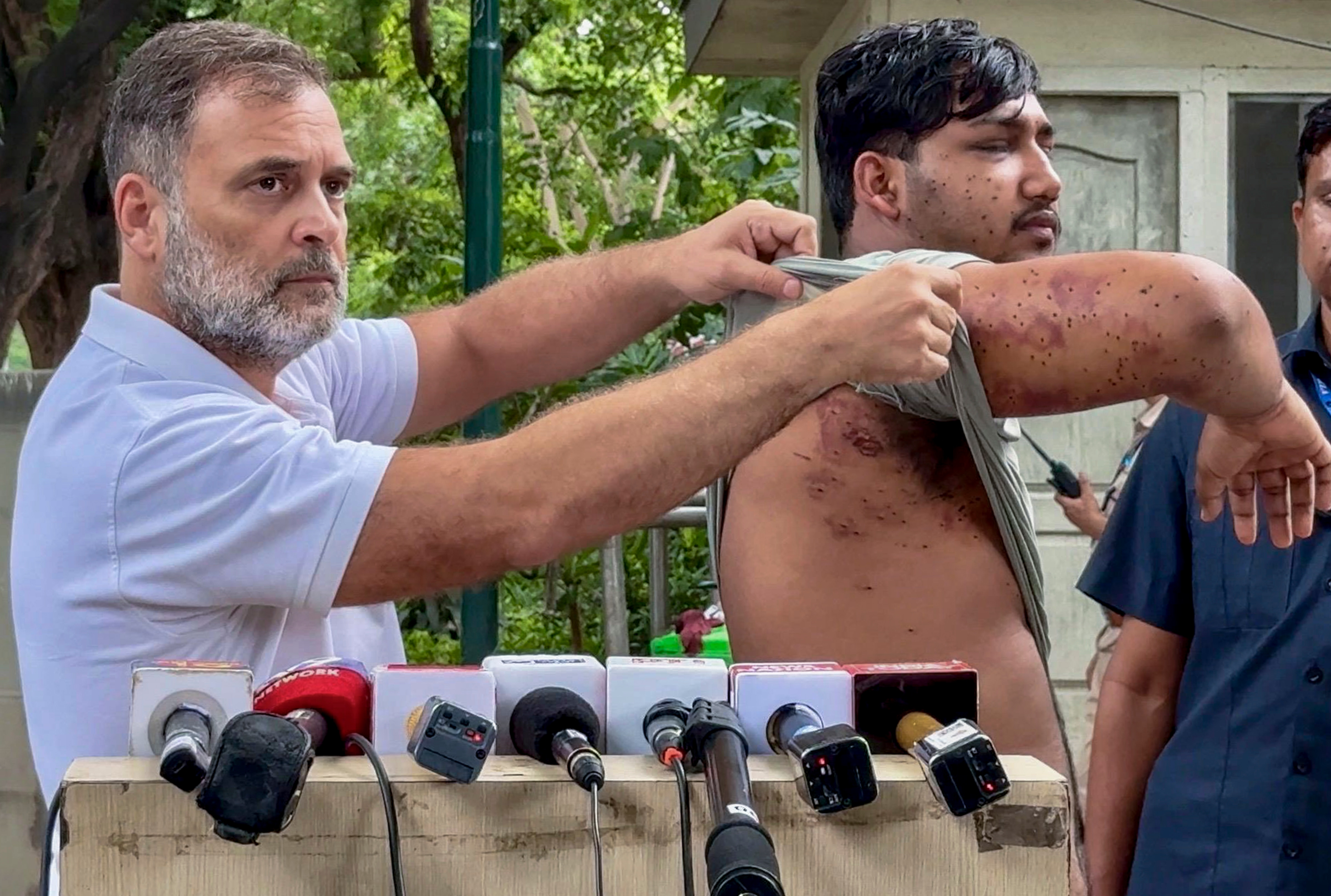 Leader of Opposition in the Lok Sabha Rahul Gandhi along with a victim of alleged pellet gun firing during a students protest march carried out by Cockroach Janata Party (CJP) on 20th July. (PTI) Leader of Opposition in the Lok Sabha Rahul Gandhi along with a victim of alleged pellet gun firing during a students protest march carried out by Cockroach Janata Party (CJP) on 20th July. (PTI)