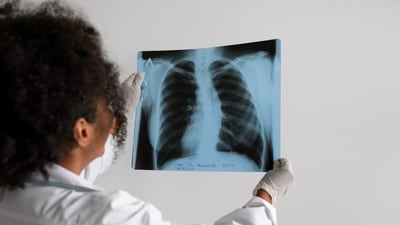 Lung cancer is a type of cancer that starts when abnormal cells grow in an uncontrolled way in the lungs. It is a serious health issue that can cause severe harm and death. (Freepik) Lung cancer is a type of cancer that starts when abnormal cells grow in an uncontrolled way in the lungs. It is a serious health issue that can cause severe harm and death. (Freepik)