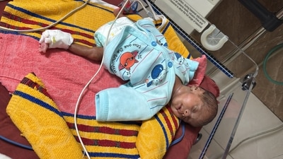 According to information released by the state government, the Mukh Mantri Sehat Yojana covered the entire hospital bill of nearly ₹3 lakh. According to information released by the state government, the Mukh Mantri Sehat Yojana covered the entire hospital bill of nearly ₹3 lakh.