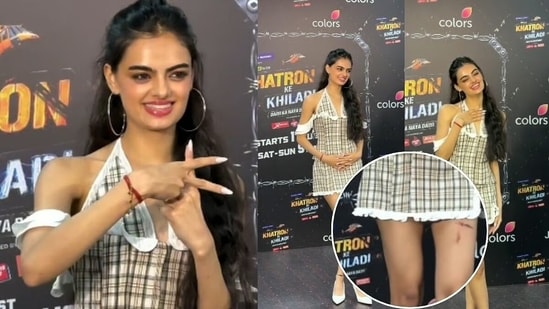 Exclusive | Did Ruhanika Dhawan get injured during KKK 15 shoot? Actor denies 