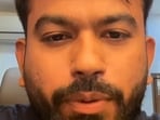 Dipke questions FIR against Ruchika Singh, asks if same yardstick will apply to BJP IT cell members for using abusive language