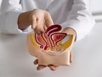 Colorectal cancer diagnoses are increasing among younger people, prompting calls for earlier screening. (Freepik)