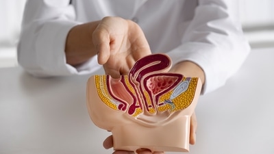 Colorectal cancer diagnoses are increasing among younger people, prompting calls for earlier screening. (Freepik) Colorectal cancer diagnoses are increasing among younger people, prompting calls for earlier screening. (Freepik)