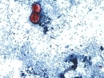 Health officials confirm two deaths in Michigan related to the cyclosporiasis outbreak.