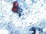FILE - This undated photo taken through a microscope provided by the CDC shows Cyclospora cayetanensis oocysts found in a fresh stool sample which had been prepared with a formalin solution and stained with safranin. 