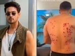 Gaurav Khanna suffers back injury while participating in Khatron Ke Khiladi 15.