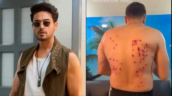 Gaurav Khanna suffers back injury while participating in Khatron Ke Khiladi 15.