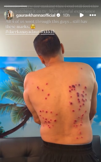 Gaurav Khanna suffers back injury. Gaurav Khanna suffers back injury.