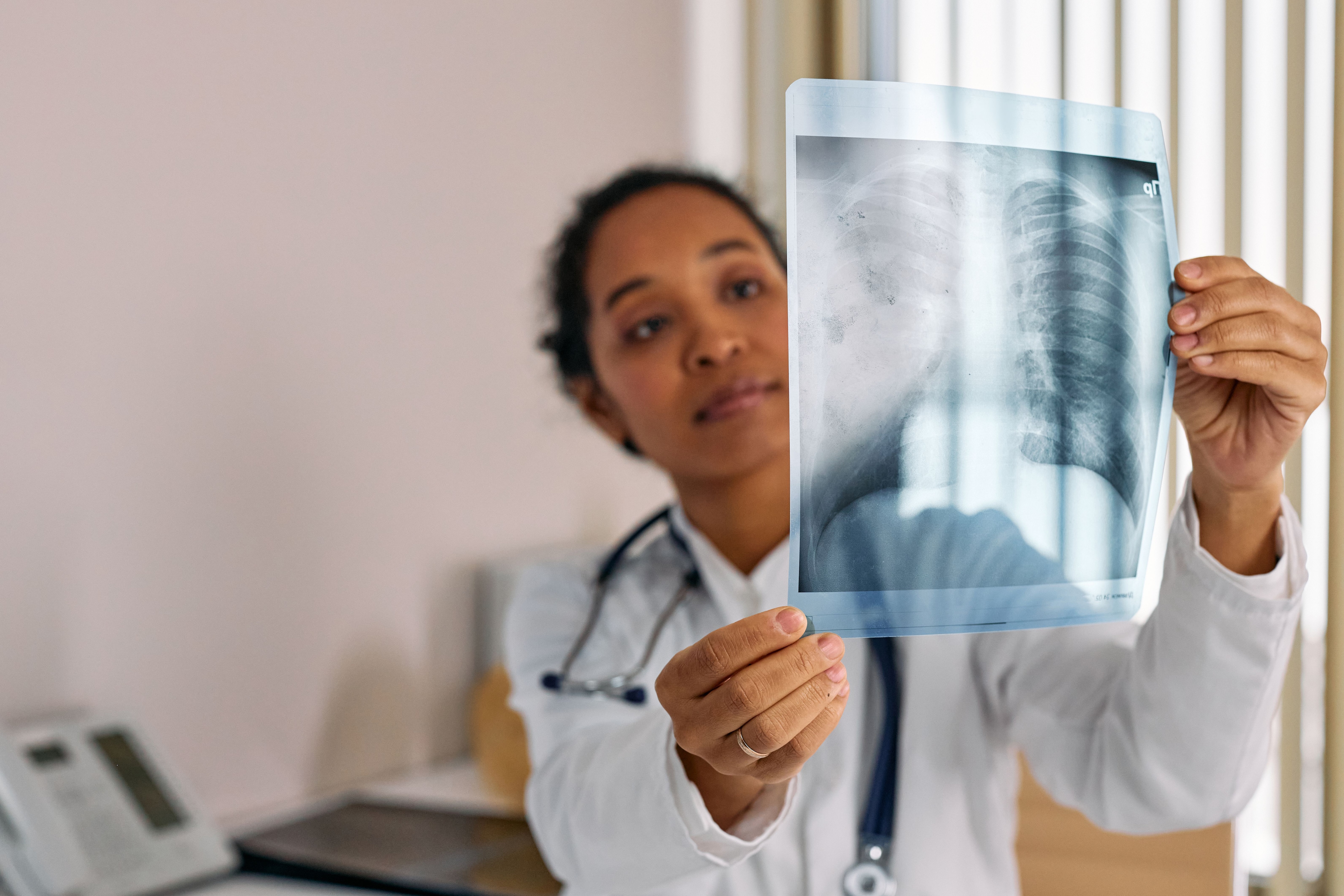 The advances in diagnostic techniques have made it possible to detect lung cancer much earlier than before. (Pexel) The advances in diagnostic techniques have made it possible to detect lung cancer much earlier than before. (Pexel)
