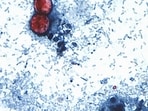 Cyclospora is a microscopic parasite that causes cyclosporiasis, an intestinal illness usually spread through contaminated fresh produce or water. (CDC via AP, File)