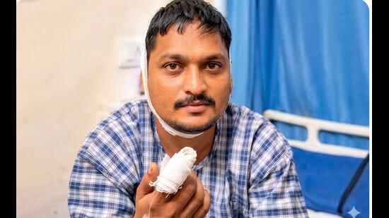 Factory owner bites off supplier’s finger over <span class='webrupee'>₹</span>77k dues