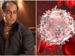 Blood cancer is a group of diseases that affect the blood, bone marrow or lymphatic system.