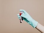 There are a few essential blood tests which men can get done after 40.