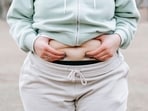 Obesity can lead to a number of health issues. Obesity can lead to a number of health issues.