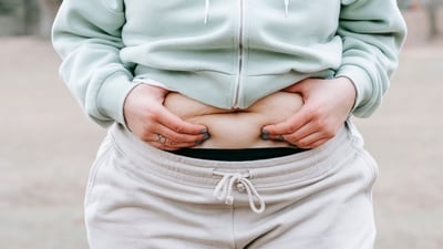 Obesity can lead to a number of health issues. (Picture credit: Pexel) Obesity can lead to a number of health issues. (Picture credit: Pexel)