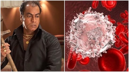 Blood cancer is a group of diseases that affect the blood, bone marrow or lymphatic system. 
