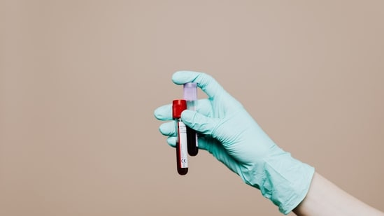 There are a few essential blood tests which men can get done after 40.