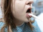 Checking the tongue can provide hints about overall health. (Pexel)