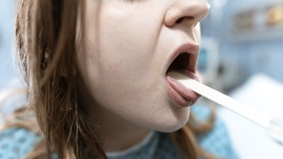 Checking the tongue can provide hints about overall health. (Pexel) Checking the tongue can provide hints about overall health. (Pexel)