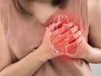 Years of exposure to high BP, abnormal cholesterol, diabetes, smoking, inactivity, and unhealthy diet gradually damage the arteries, increasing the risk of heart attack. 