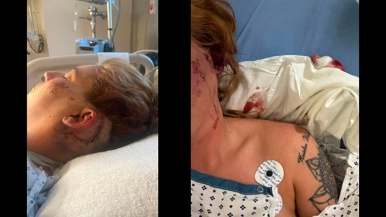 Christen Phillips, a North Carolina woman who delivers for DoorDash and Uber Eats is recovering after an alleged road rage attack. (Credits: Facebook/Christen Alyse Phillips)