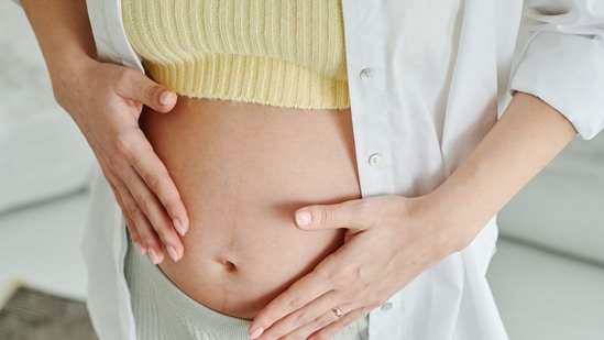 Pregnancy causes stretch marks and loose skin.