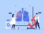 Dr. Prriya Eshpuniyani emphasises that lung cancer risk factors extend beyond smoking, including environmental and genetic influences. (Freepik)