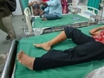 Staff at Rukminibai Hospital said around 150 more people sought treatment for dog bites on Monday.