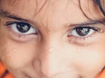 Often called 'dancing eyes,' nystagmus is an involuntary eye condition caused by neurological factors or early visual disruptions.