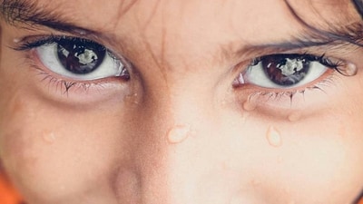 Often called 'dancing eyes,' nystagmus is an involuntary eye condition caused by neurological factors or early visual disruptions. (Pexel) Often called 'dancing eyes,' nystagmus is an involuntary eye condition caused by neurological factors or early visual disruptions. (Pexel)
