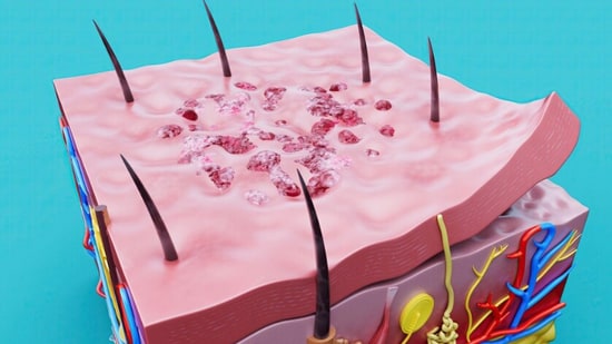 Understanding how follicles work, and why they sometimes stop working, can change how you approach hair health.
