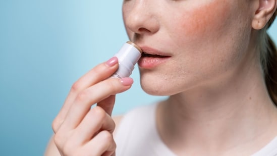 These lip balms are my saviour (Pexels)