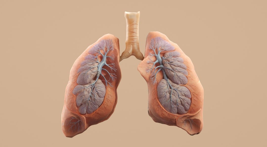 Lung cancer cells consume nutrients that healthy tissues also needed for. (Unsplash) Lung cancer cells consume nutrients that healthy tissues also needed for. (Unsplash)